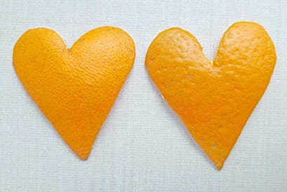 ¿Podría una simple deficiencia localizada de vitamina C causarle un ataque al corazón?